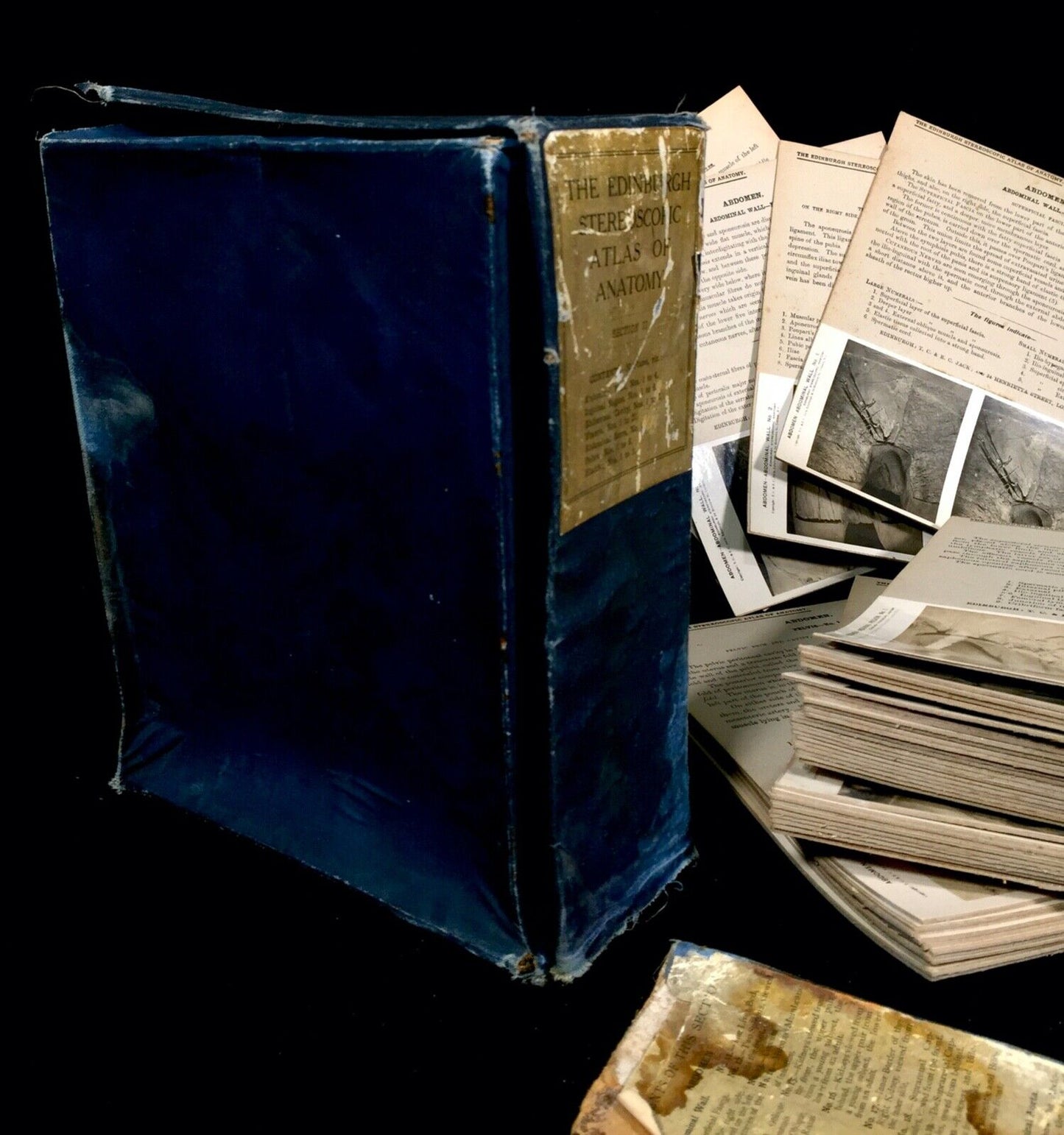 Antique Pair of Boxed Edinburgh Stereoscopic Atlas of Anatomy Cards Views c.1905