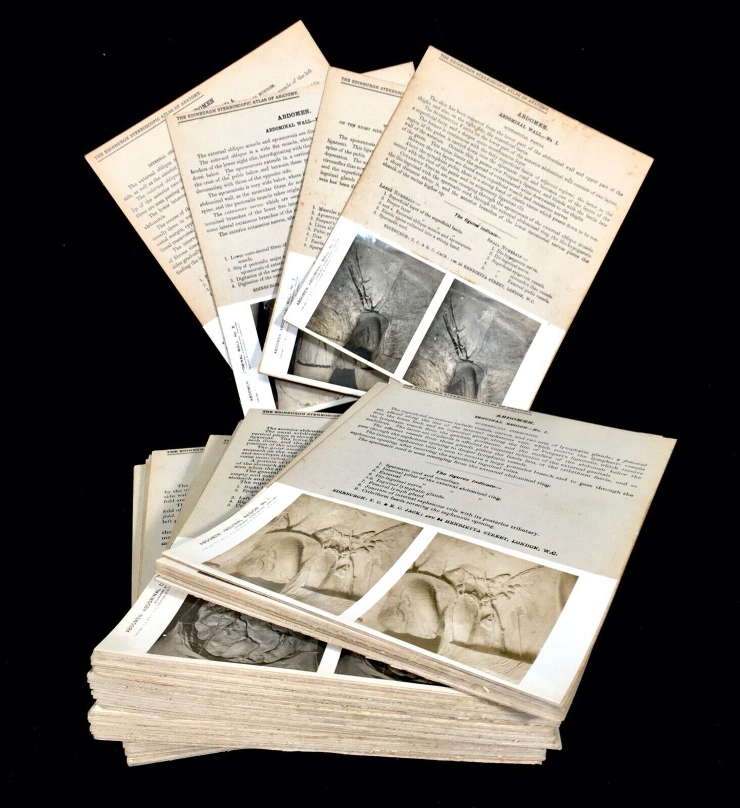 Antique Pair of Boxed Edinburgh Stereoscopic Atlas of Anatomy Cards Views c.1905