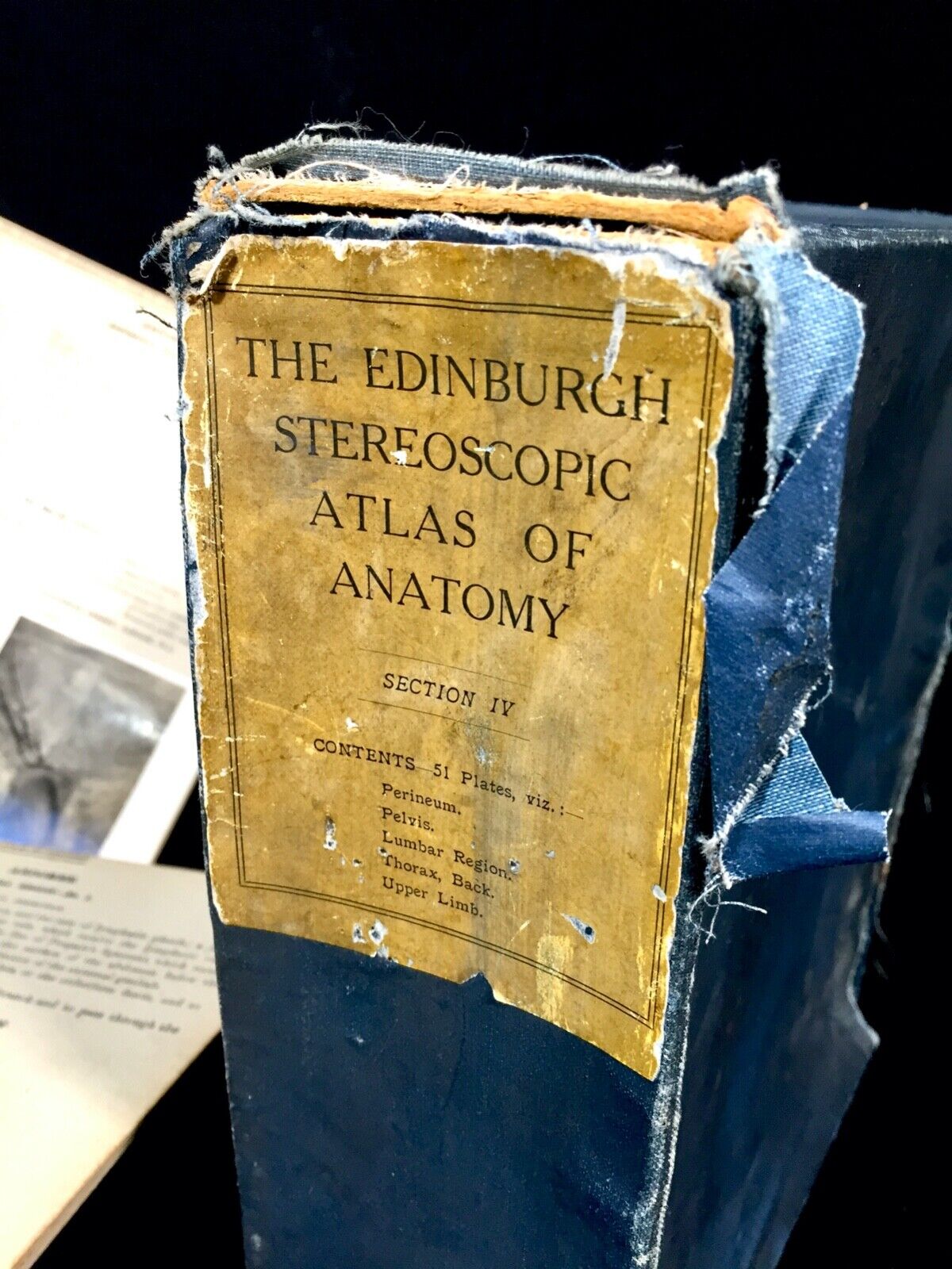 Antique Pair of Boxed Edinburgh Stereoscopic Atlas of Anatomy Cards Views c.1905